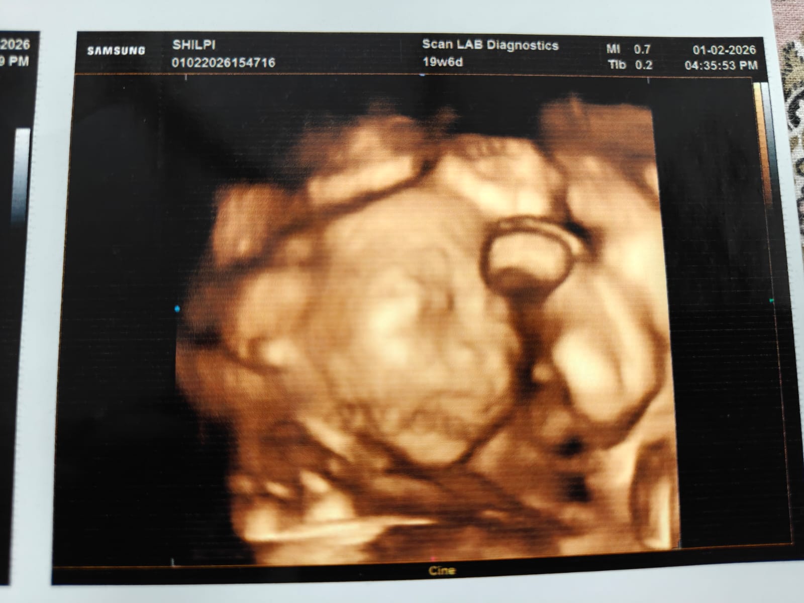 The Level 2 Scan